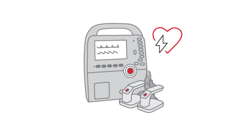Manual external defibrillator