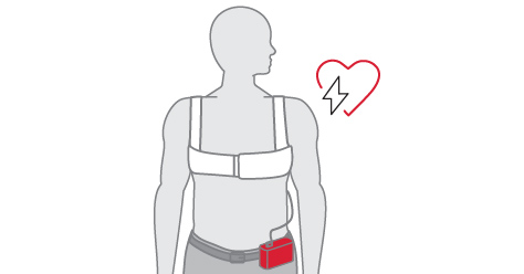 Wearable cardiac defibrillator